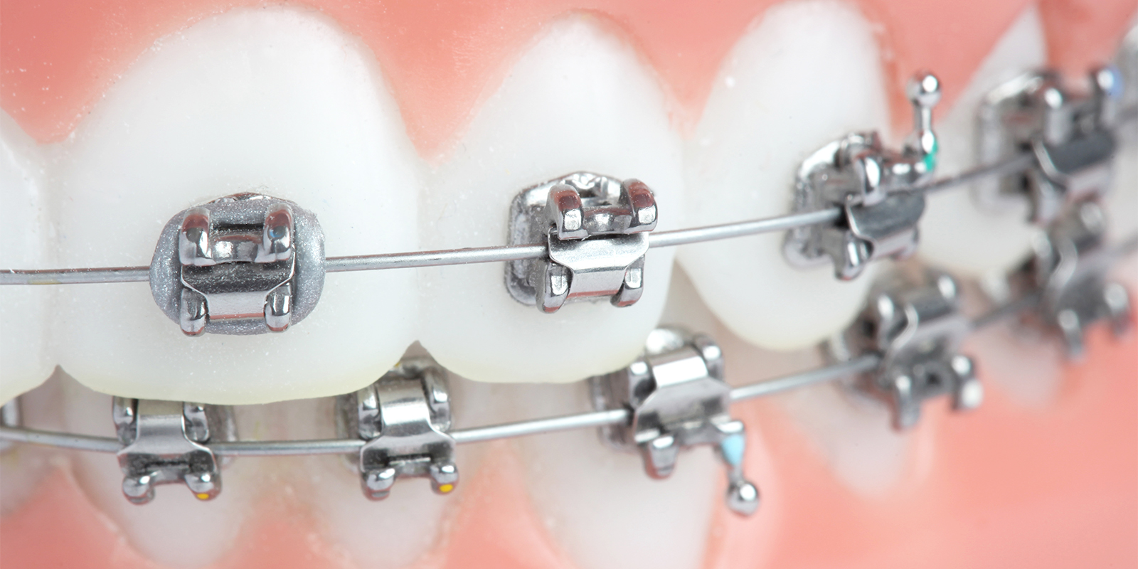 歯科矯正専門医師による「最新技術を用いた矯正治療」